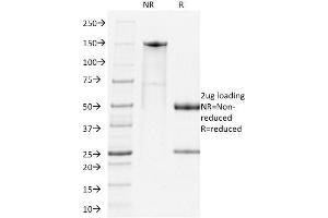 SDS-PAGE Analysis Purified PD1 Rat Monoclonal Antibody (RMP-1-14). (PD-1 抗体)