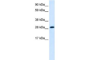 WB Suggested Anti-ABT1 Antibody Titration:  1. (Activator of Basal Transcription 1 抗体  (Middle Region))