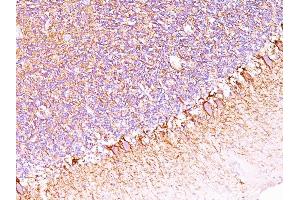 Formalin-fixed, paraffin-embedded human Cerebellum stained with Neurofilament Monoclonal Antibody (SPM563). (NEFH 抗体)