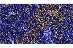Detection of TLR5 in Rat Lymph node Tissue using Polyclonal Antibody to Toll Like Receptor 5 (TLR5) (TLR5 抗体  (AA 325-644))