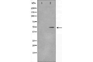 Western blot analysis on 293 cell lysate using DLX3 Antibody,The lane on the left is treated with the antigen-specific peptide. (DLX3 抗体  (Internal Region))