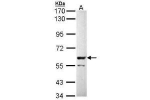Western Blot analysis: PPP3CB antibody staining of Molt-4 whole cell lysate (Lane A, 30 µg) at 1/5000 dilution. (PPP3CB 抗体)