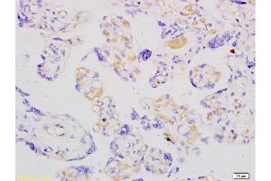 Formalin-fixed and paraffin embedded human placenta labeled with Anti-ADFP Polyclonal Antibody, Unconjugated  at 1:200 followed by conjugation to the secondary antibody and DAB staining. (ADRP 抗体  (AA 31-130))