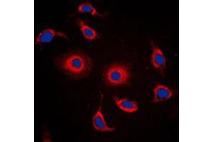 Immunofluorescent analysis of FXR2 staining in HepG2 cells. (FXR2 抗体  (C-Term))