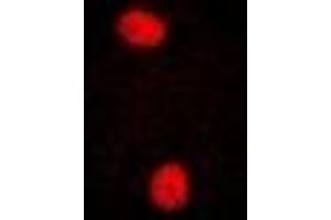 Immunofluorescent analysis of PRPF3 staining in U2OS cells. (PRPF3 抗体)
