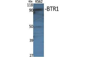 Western Blot (WB) analysis of specific cells using BTR1 Polyclonal Antibody. (SLC4A11 抗体  (Internal Region))