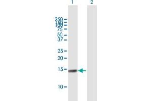 Western Blot analysis of CST4 expression in transfected 293T cell line by CST4 MaxPab polyclonal antibody.