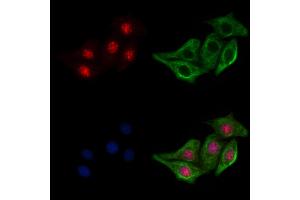 ABIN6256682 and ABIN6267213 staining H2O2 treated Hela cells by IF/ICC.