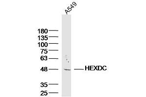 A549 lysates probed with HEXDC Polyclonal Antibody, Unconjugated  at 1:300 dilution and 4˚C overnight incubation. (HEXDC 抗体  (AA 1-100))