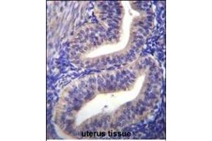 TBPL2 Antibody (N-term) (ABIN656105 and ABIN2845447) immunohistochemistry analysis in formalin fixed and paraffin embedded human uterus tissue followed by peroxidase conjugation of the secondary antibody and DAB staining. (Tbpl2 抗体  (N-Term))