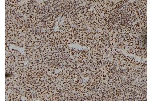 ABIN6262339 and ABIN6279487 at 1/100 staining Mouse spleen tissue by IHC-P. (Homeobox A11 抗体)