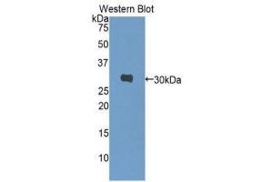 Western Blotting (WB) image for anti-Carbonic Anhydrase I (CA1) (AA 2-261) antibody (ABIN1077892)