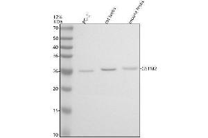 Western blot analysis of GSTM2 using anti-GSTM2 antibody (ABIN7825412).
