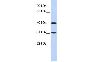 WB Suggested Anti-FAM46D Antibody Titration: 0. (FAM46D 抗体  (Middle Region))