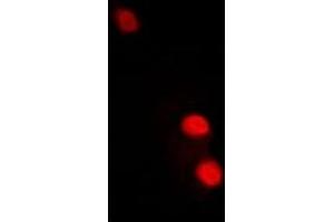 Immunofluorescent analysis of TFIIF RAP 30 staining in A549 cells. (GTF2F2 抗体)
