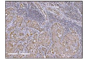 IHC analysis of FABP-1/GOT2 using anti-FABP-1/GOT2 antibody (ABIN7601426). (GOT2 抗体  (AA 35-430))