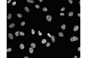 Immunofluorescent staining of A549 (ATCC CCL-185) cells. (NONO 抗体  (AA 368-471))