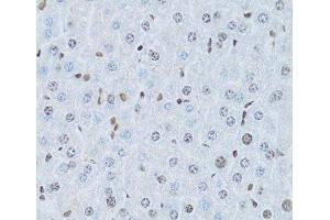 Immunohistochemistry of paraffin-embedded Mouse liver using HNF4A Polyclonal Antibody at dilution of 1:100 (40x lens). (HNF4A 抗体)