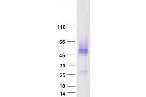 Validation with Western Blot
