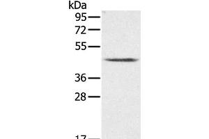 Western Blot analysis of K562 cell using PLTP Polyclonal Antibody at dilution of 1:200 (PLTP 抗体)