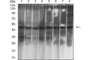 Western Blotting (WB) image for anti-Keratin 19 (KRT19) (AA 80-400) antibody (ABIN7193468)