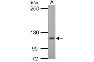 WB Image Sample (30 ug of whole cell lysate) A: 293T 5% SDS PAGE antibody diluted at 1:1000 (DLGAP5 抗体  (Internal Region))