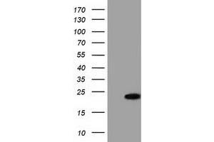 Western Blotting (WB) image for anti-Acireductone Dioxygenase 1 (ADI1) antibody (ABIN1496484) (ADI1 抗体)