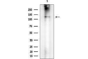 Western blot analysis of lysates from Rat brain, using Phospho-CBL (Tyr674) Antibody at 1/1000 dilution.