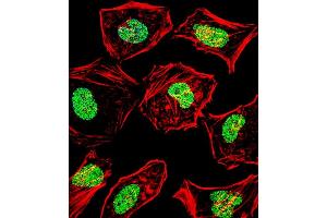 Fluorescent confocal image of Hela cell stained with HAND2 Antibody (Center) (ABIN1538642 and ABIN2848660). (HAND2 抗体  (AA 81-110))