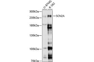 Western Blotting (WB) image for anti-Sodium Channel, Voltage-Gated, Type II, alpha Subunit (SCN2A) (AA 275-401) antibody (ABIN6147435)