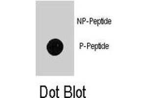 Dot blot analysis of MAP1LC3B (phospho T12) polyclonal antibody  on nitrocellulose membrane.