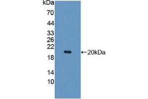 Western blot analysis of recombinant Human IL10Rb. (IL10RB 抗体  (AA 87-243))