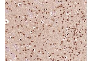 Immunohistochemistry (Paraffin-embedded Sections) (IHC (p)) image for anti-Coiled-Coil Domain Containing 42 (CCDC42) (AA 221-312) antibody (ABIN872760)