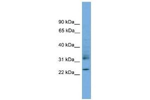 RHOJ antibody used at 1 ug/ml to detect target protein. (RHOJ 抗体  (Middle Region))