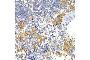 Immunohistochemistry of paraffin-embedded rat spleen using NOTCH1 antibody. (Notch1 抗体)
