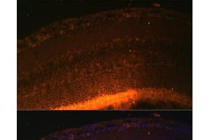 Immunofluorescence analysis of Mouse retina using GRK1 Polyclonal Antibody at dilution of 1:100 (40x lens). (GRK1 抗体)