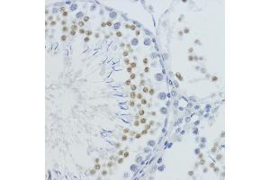 Immunohistochemistry of paraffin-embedded rat testis using MonoMethyl-Histone H4-K20 antibody (ABIN3016044, ABIN3016045, ABIN3016046, ABIN1680258 and ABIN6219531) at dilution of 1:200 (40x lens).