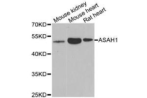 Western blot analysis of extracts of various cell lines, using ASAH1 antibody. (ASAH1 抗体  (AA 140-389))