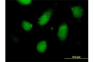 Immunofluorescence (IF) image for anti-Regulatory Solute Carrier Protein, Family 1, Member 1 (RSC1A1) (AA 1-617) antibody (ABIN519924)