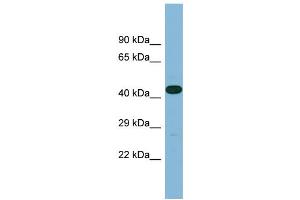 Western Blotting (WB) image for anti-Leucine Rich Repeat Containing 49 (LRRC49) (C-Term) antibody (ABIN2787019) (LRRC49 抗体  (C-Term))