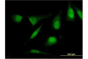 Immunofluorescence of monoclonal antibody to RASSF4 on HeLa cell. (RASSF4 抗体  (AA 1-321))