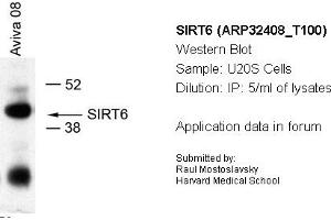 Image no. 1 for anti-Sirtuin 6 (SIRT6) (Middle Region) antibody (ABIN2779624) (SIRT6 抗体  (Middle Region))