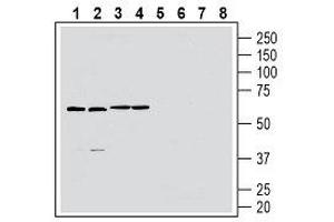 Western blot analysis of rat brain membranes (lanes 1 and 5), mouse brain lysate (lanes 2 and 6), rat spleen lysate (lanes 3 and 7) and mouse spleen membranes (lanes 4 and 8): - 1-4. (GPR174 抗体  (2nd Extracellular Loop))