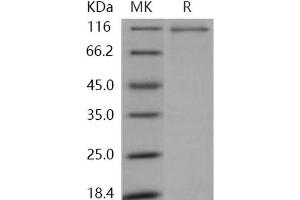 Western Blotting (WB) image for Mitogen-Activated Protein Kinase Kinase Kinase Kinase 2 (MAP4K2) protein (GST tag,His tag) (ABIN7317061) (MAP4K2 Protein (GST tag,His tag))