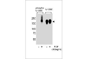 Western blot analysis of extracts from A431 cells,untreated or treated with EGF,100 ng/mL , using phospho-ERBB2-(left) or ERBB2 Antibody (right) (ErbB2/Her2 抗体  (pTyr1139))