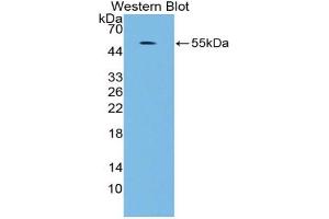 Western blot analysis of the recombinant protein. (MAPK7 抗体  (AA 560-793))
