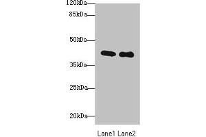 Western blot All lanes: P2RY13 antibody at 3 μg/mL Lane 1: HT29 whole cell lysate Lane 2: Colo320 whole cell lysate Secondary Goat polyclonal to rabbit IgG at 1/10000 dilution Predicted band size: 41, 39 kDa Observed band size: 41 kDa (Purinergic Receptor P2Y, G-Protein Coupled, 13 (P2RY13) (AA 162-190) 抗体)