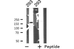 Western blot analysis of GRF-1 expression in 293 whole cell lysates,The lane on the left is treated with the antigen-specific peptide. (GRLF1 抗体  (Internal Region))