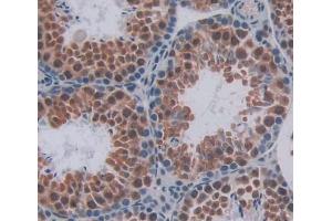 Used in DAB staining on fromalin fixed paraffin- embedded testis tissue (HMG20B 抗体  (AA 1-213))