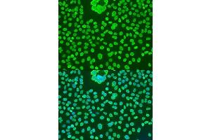 Immunofluorescence analysis of U2OS cells using POU5F1 antibody. (OCT4 抗体)